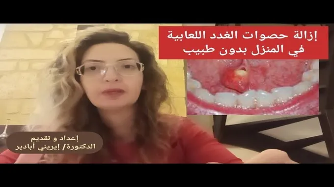 علاج التهاب الحلق في المنزل بطرق مبتكرة